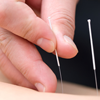 Longmont Acupuncture